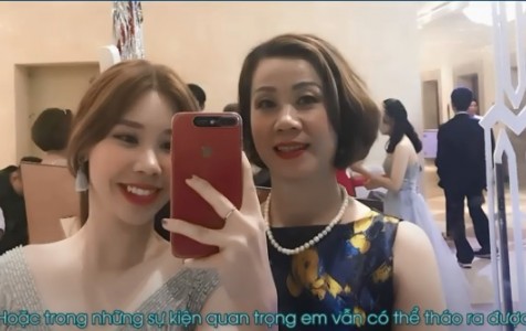 Trần Khánh Vy niềng răng INVISALIGN khắc phục tình trạng hô